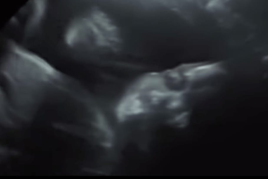 Ce bébé salue ses parents pendant l'échographie