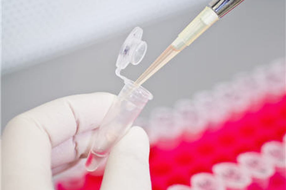 Cancer du pancréas : espoir de traitement grâce à un virus de l'herpès