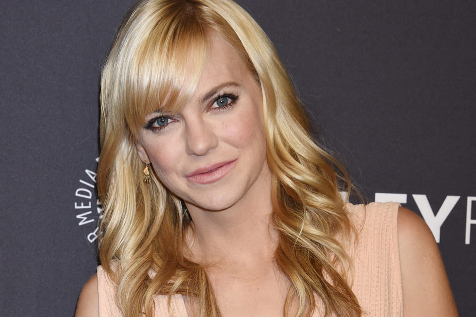 Anna Faris, apr&egrave;s&nbsp;: la l&egrave;vre sup&eacute;rieure gonfl&eacute;e