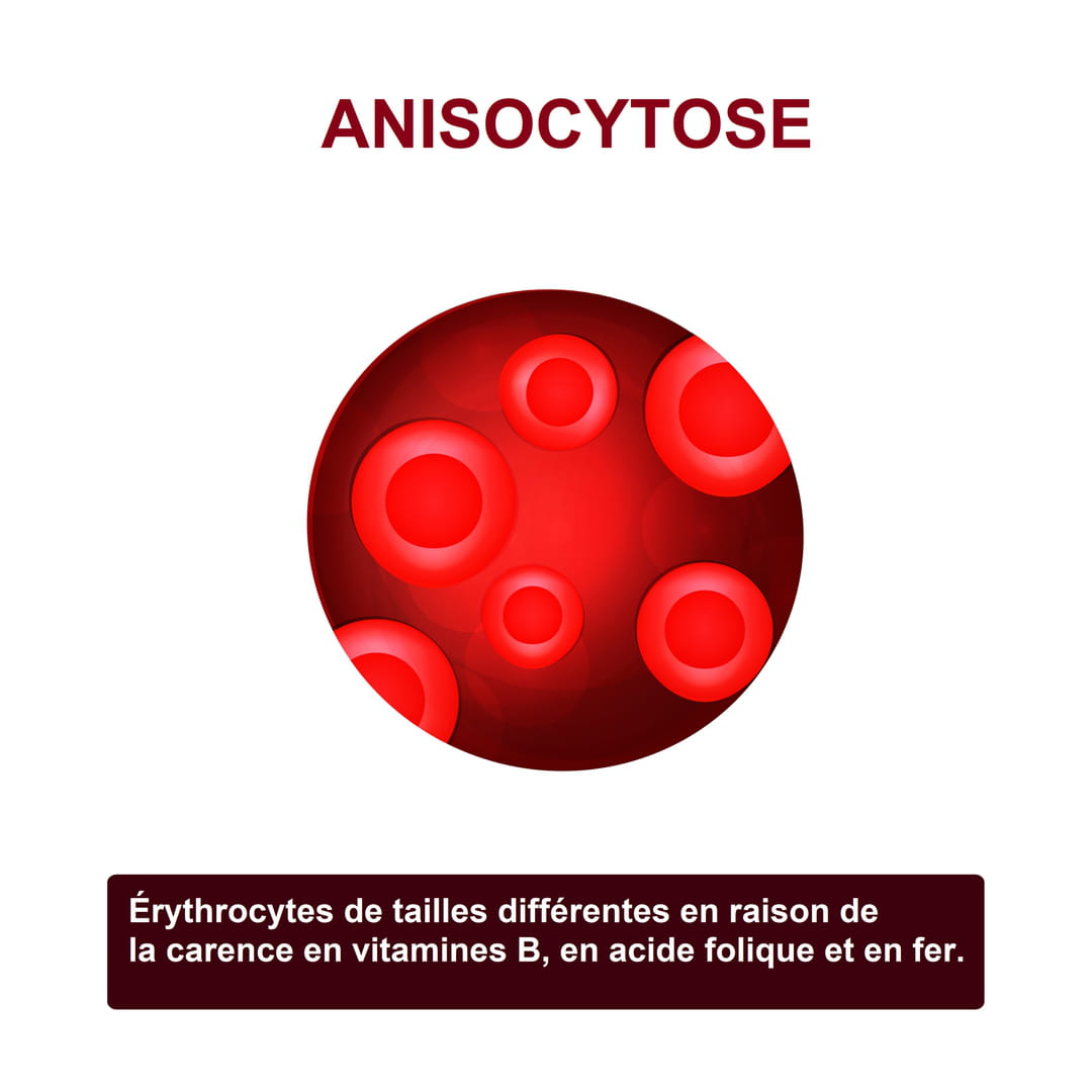Anisocytose Ce Qu Elle Est Ses Causes Et Son Traitement GOHA