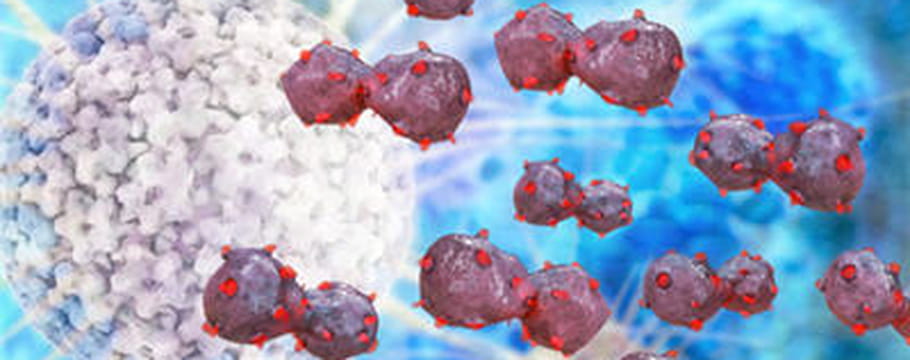 Leucocytes élevés Dans Les Urines Cancer Analyses médicales : tous les articles le Journal des Femmes