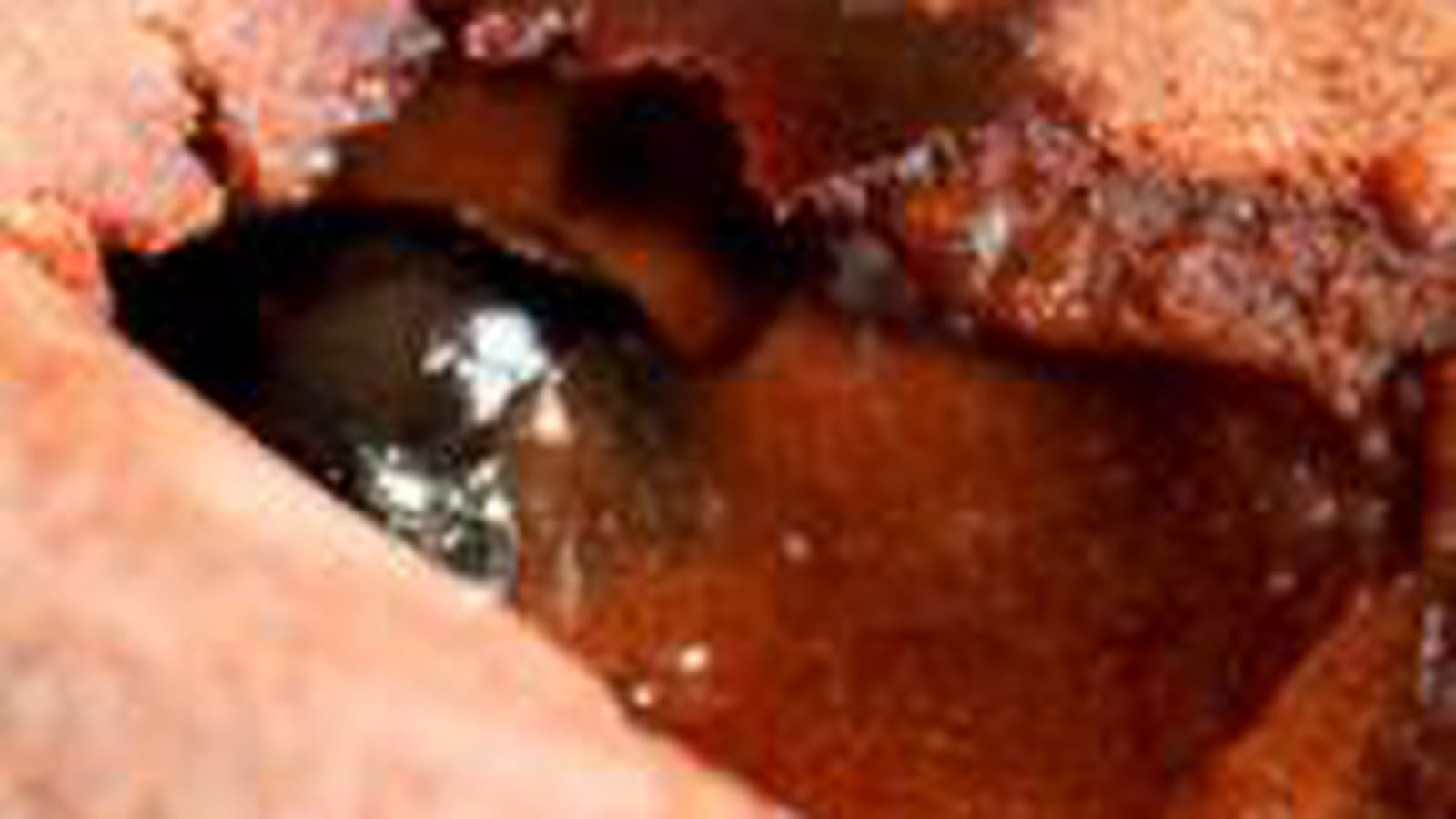 Coulant au chocolat et cerise amarena