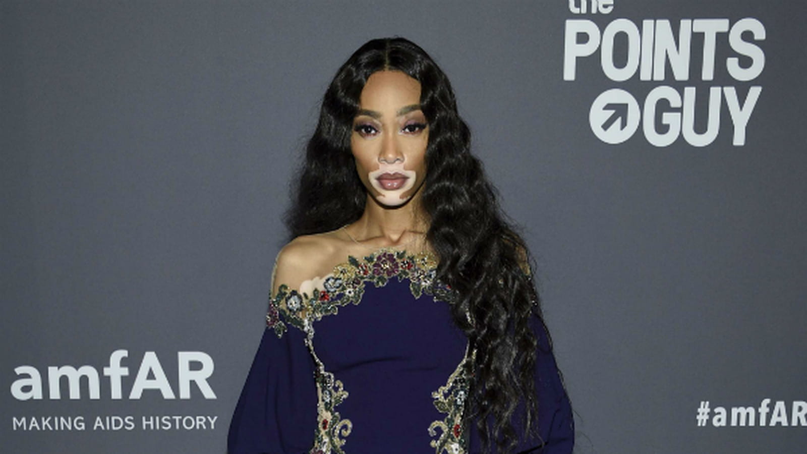 Winnie Harlow