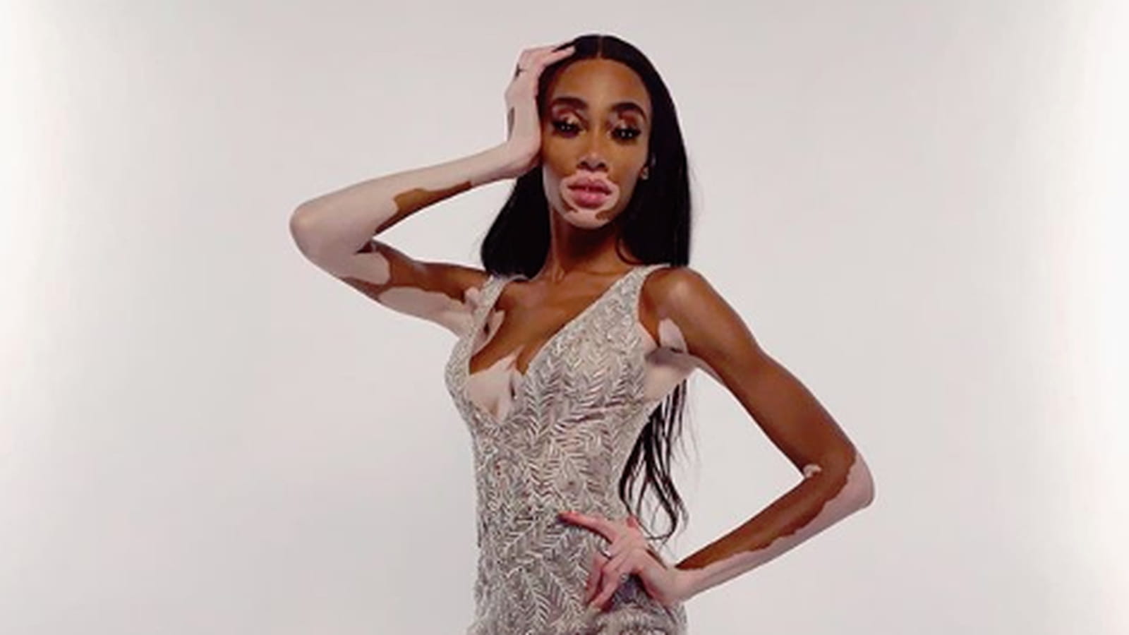 Winnie Harlow