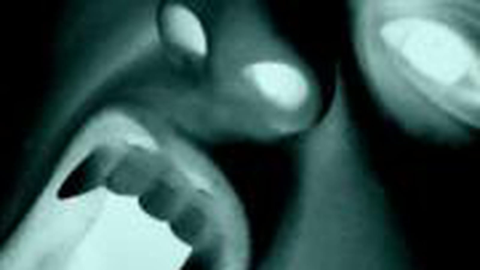 Un vampire mordu d'Halloween