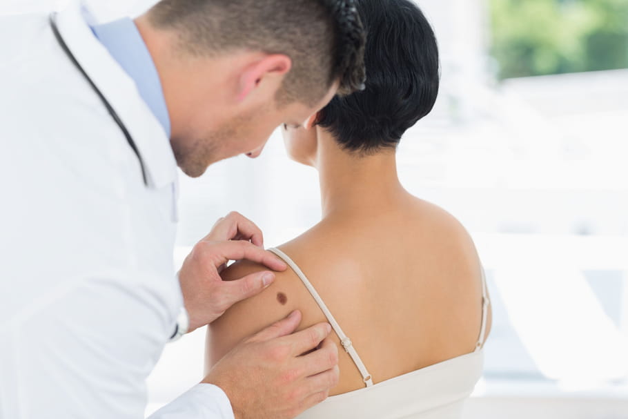 Cancer de la peau : cause, symptôme, traitement, à quel âge ?