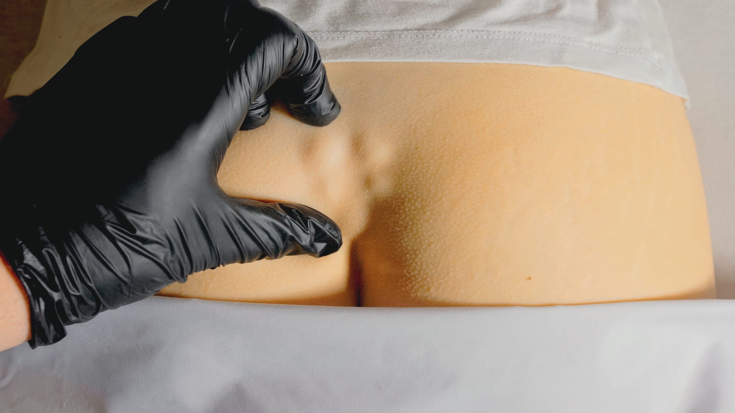 Coccyx : définition, rôle et schéma