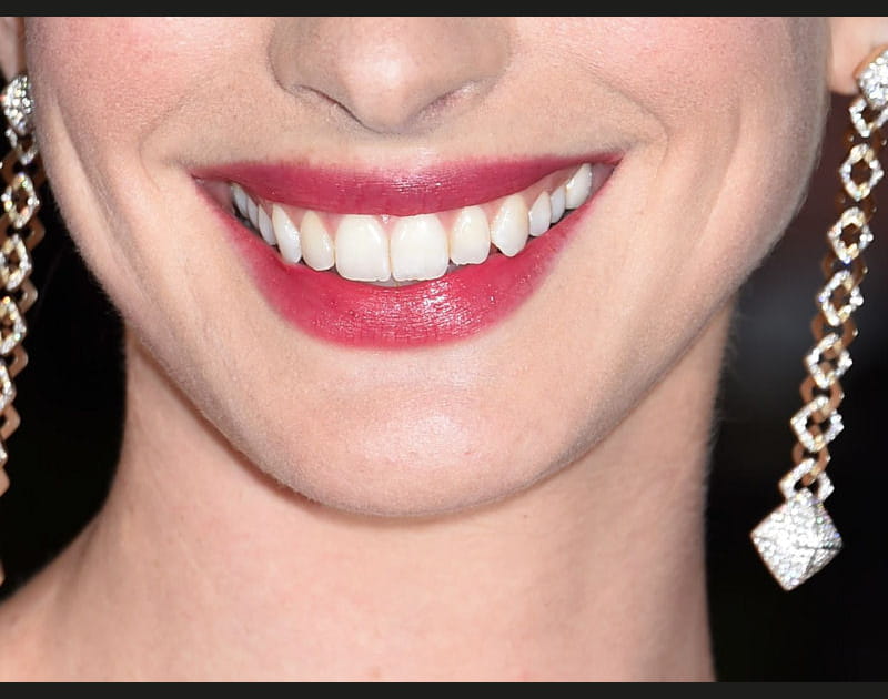 A qui est ce sourire glamour ?