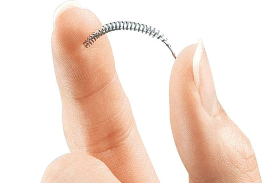 Les implants Essure définitivement retirés du marché