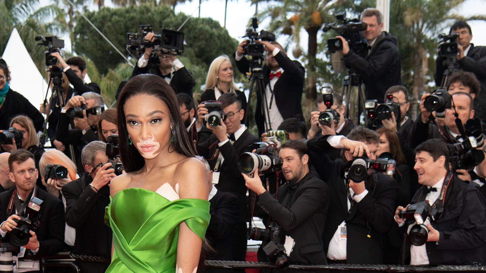 Winnie Harlow