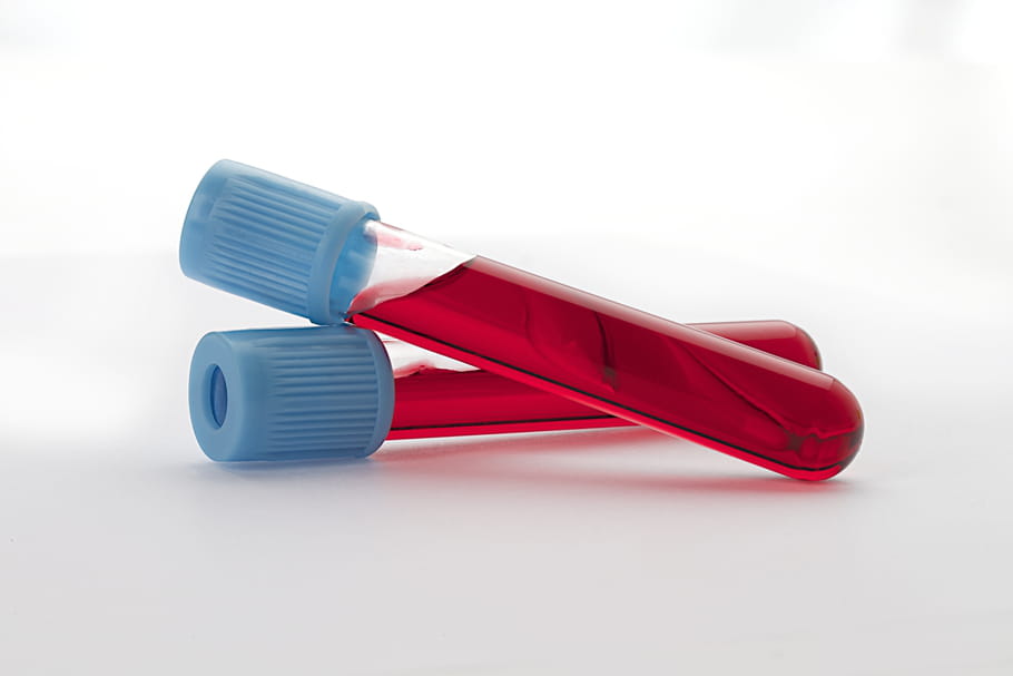 Monocytes élevés, bas : quel est leur rôle ?
