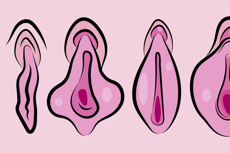 Vaginoplastie : la chirurgie qui resserre le sexe de la femme