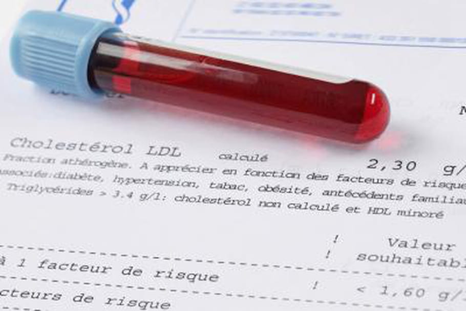 L'hormone lutéinisante