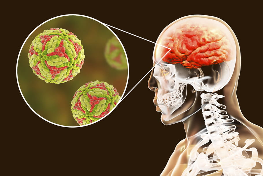 Encéphalite japonaise : symptômes, pays à risque, vaccin