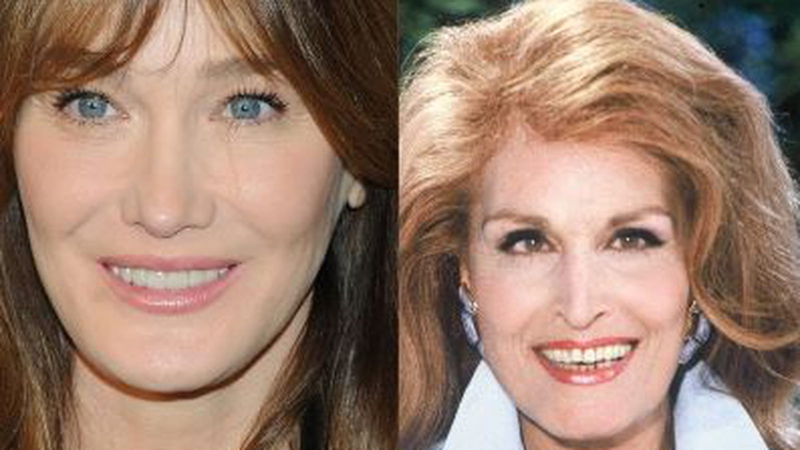 Carla Bruni et Dalida 