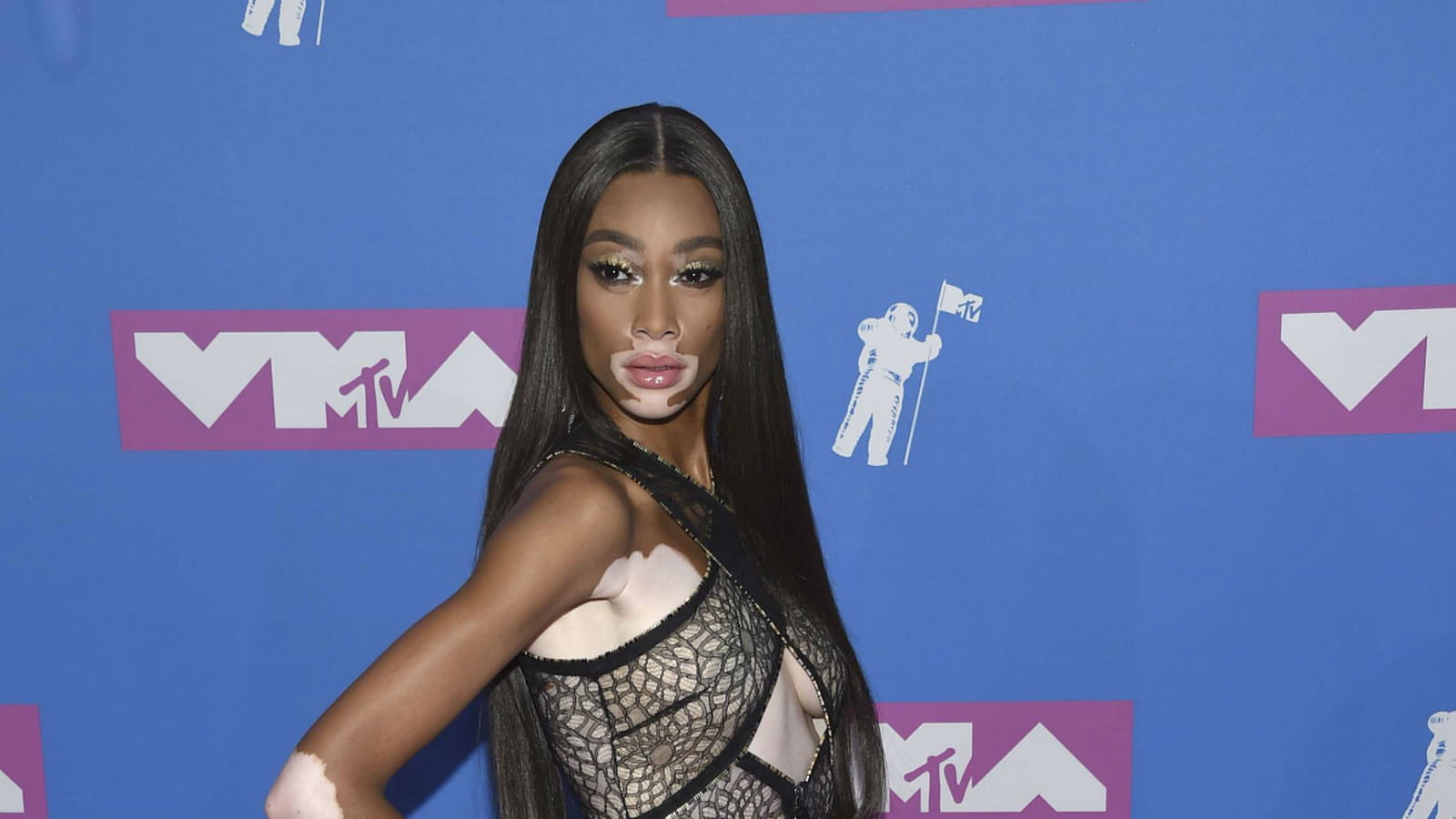 Winnie Harlow  
