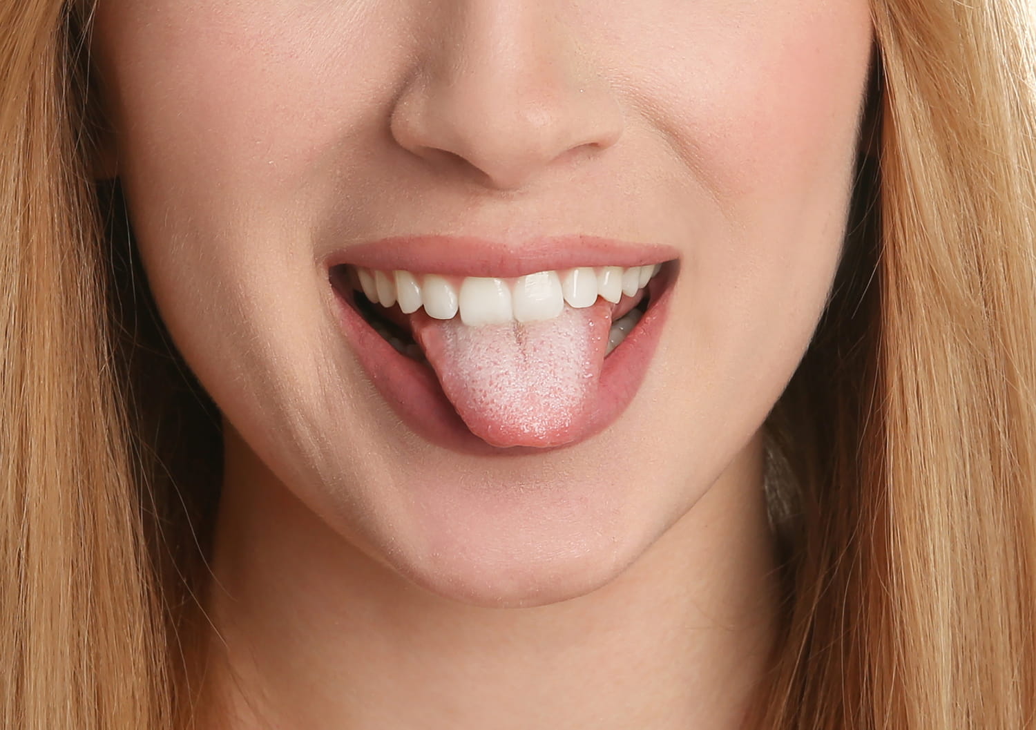 Mouth yeast infection: symptoms, treatments, contagious?