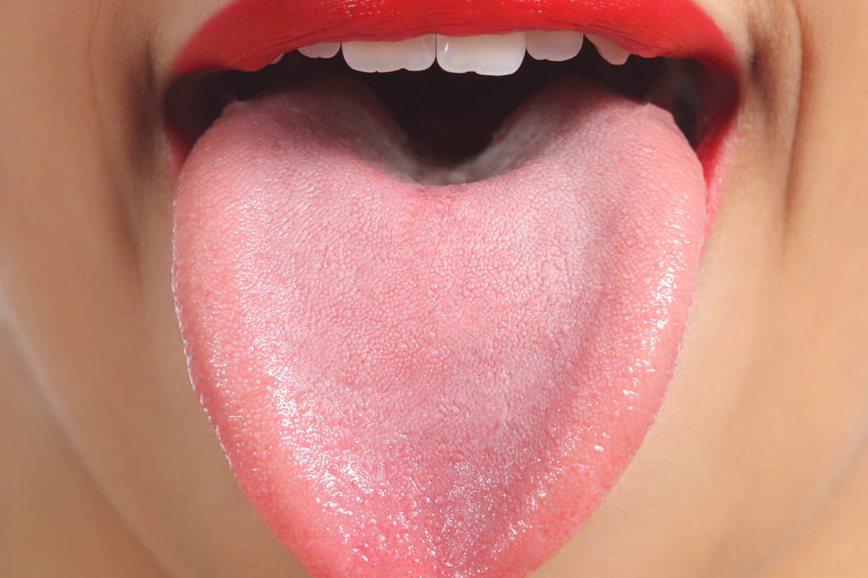 Glossite Symptomes Duree Comment La Soigner