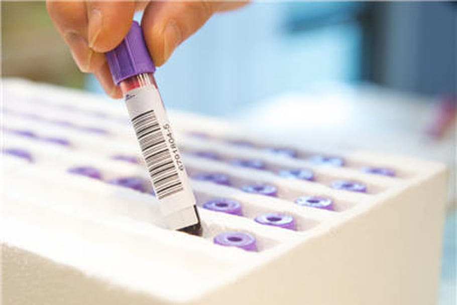 Dépistage de l'hépatite C : la Haute autorité de santé favorable aux tests rapides