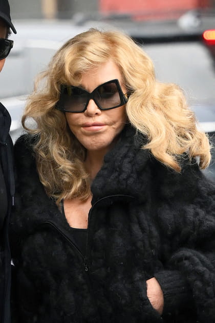 Jocelyne Wildenstein admet qu'une opération de chirurgie esthétique a été ratée