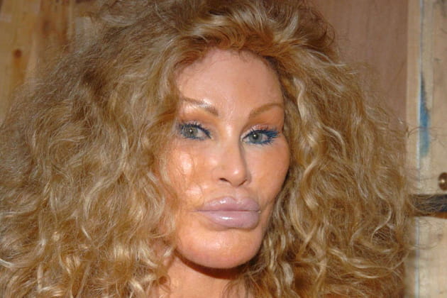 Jocelyne Wildenstein La Reine Du Bistouri