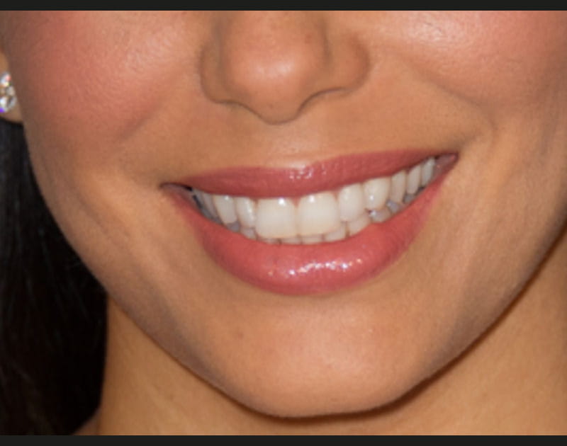 A qui est cette bouche glossy ?