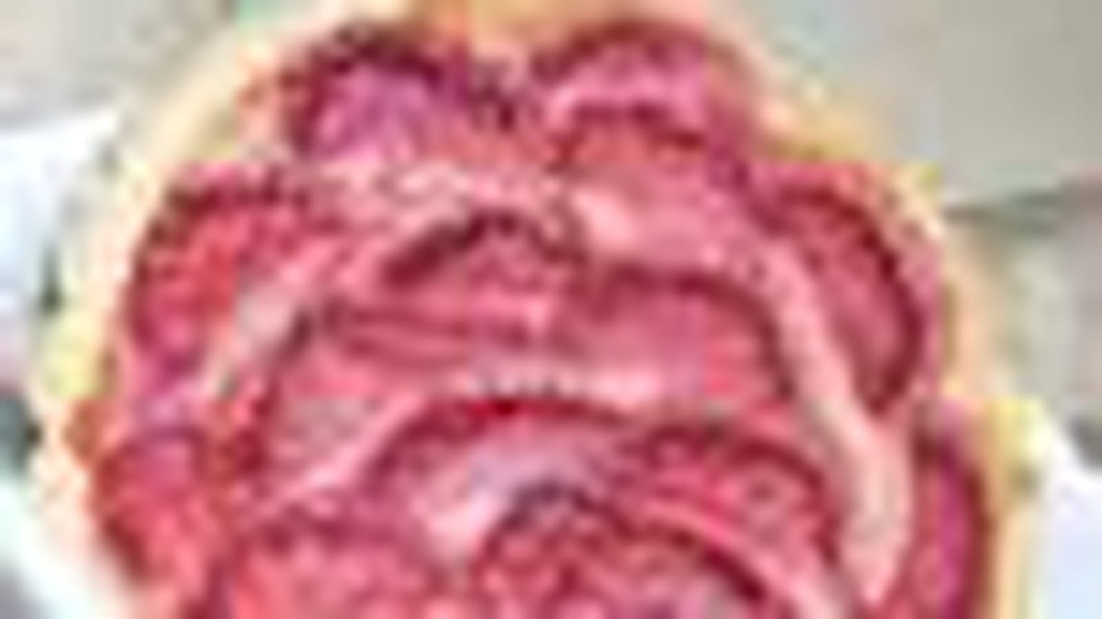 Tartelette fraises-rhubarbe