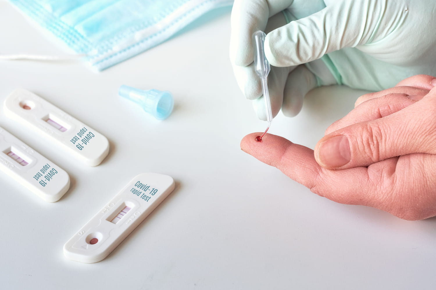 Test sérologique Covid : avant vaccin, pharmacie, résultat, est-ce gratuit ?