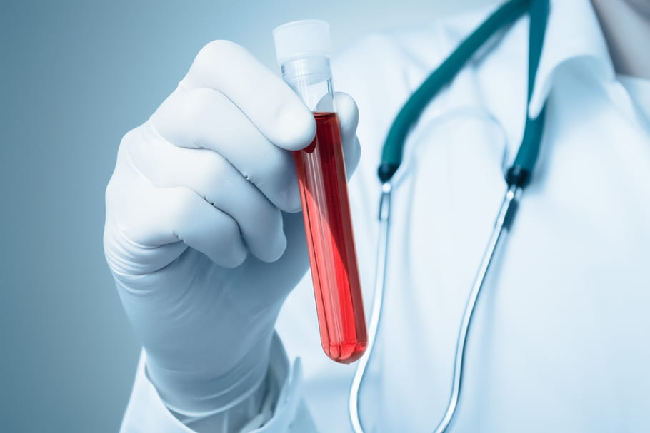 Fibrinogène : taux, norme, analyser son dosage