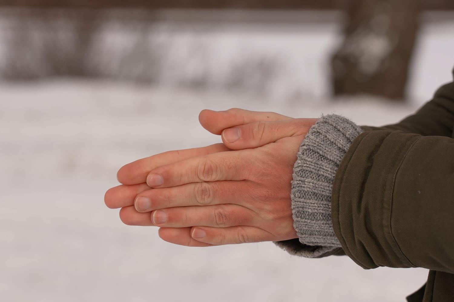what are the causes of Raynaud’s syndrome?