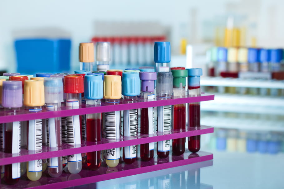 Biobanques : quand les patients participent à la recherche médicale