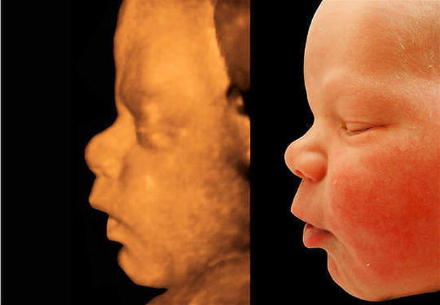 Une ressemblance frappante