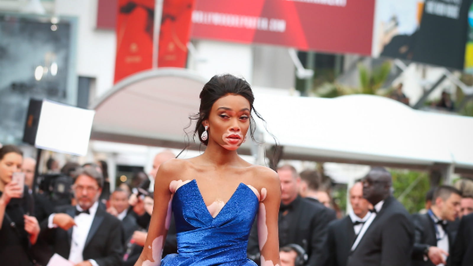 Winnie Harlow