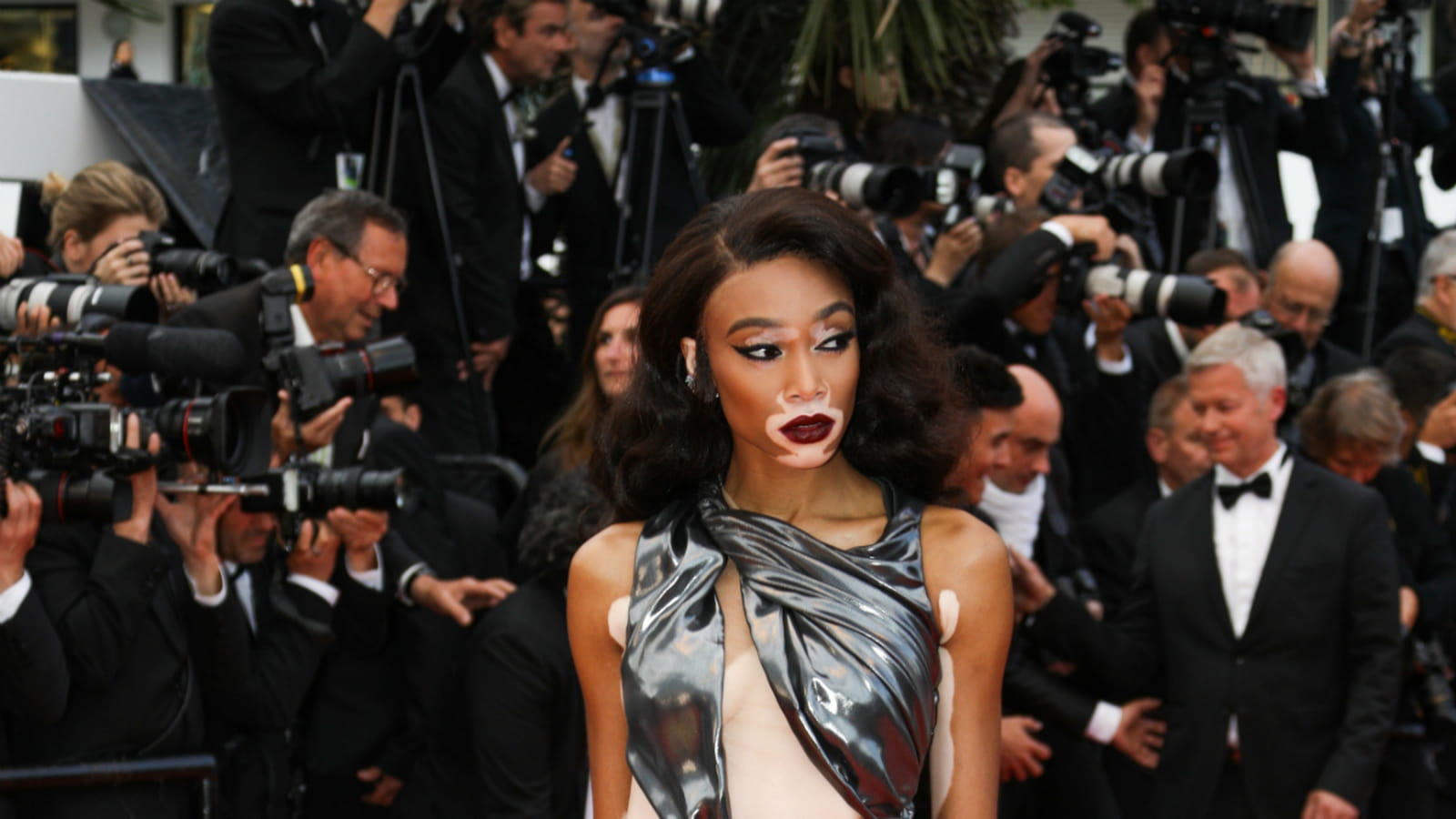 Winnie Harlow 