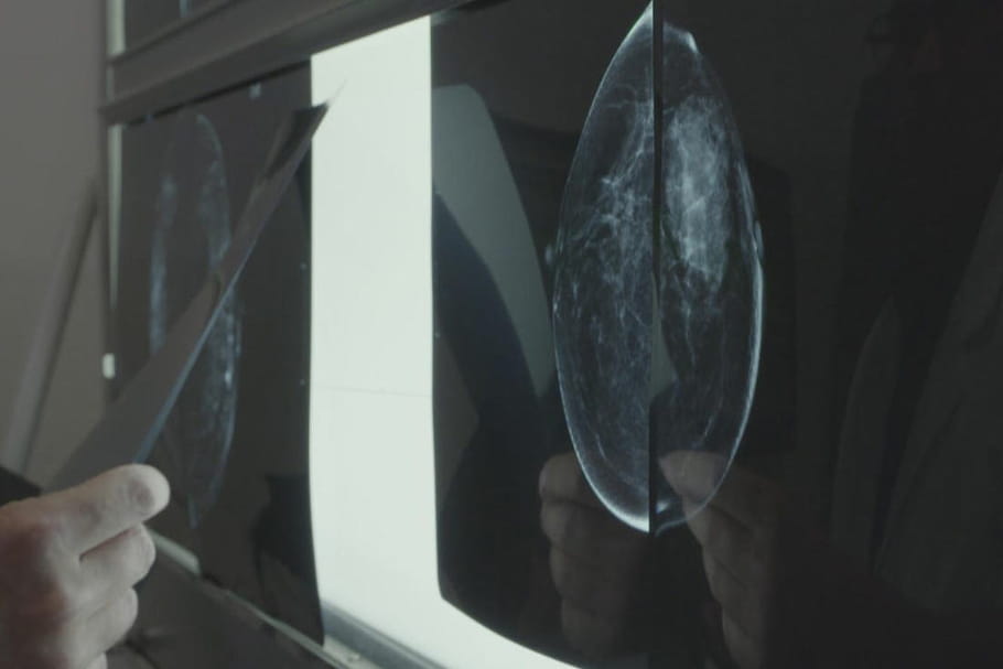 "Au nom de tous les seins", un documentaire qui bouscule nos certitudes sur le dépistage