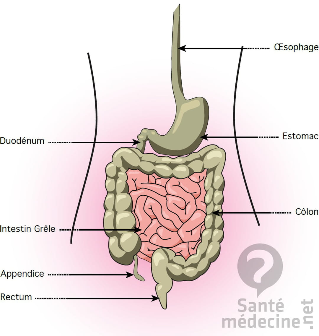 Appendicite Causes Sympt mes Op ration Cicatrice