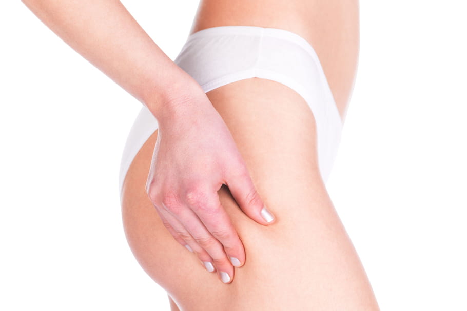 Le conseil minceur de Valérie Orsoni : combattre la cellulite
