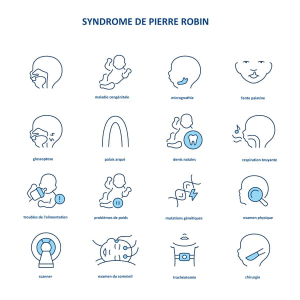 Schéma syndrome de Pierre Robin