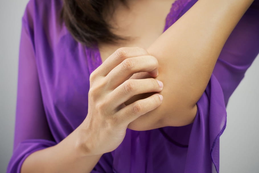 Comment l'hypnose peut aider les malades de psoriasis