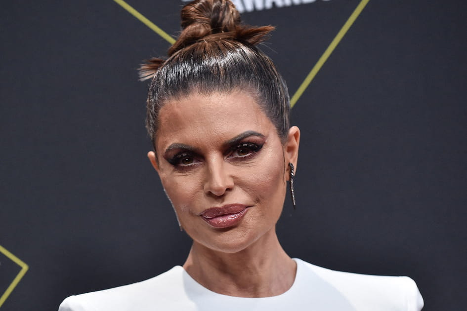 Lisa Rinna, apr&egrave;s&nbsp;: une bouche XXL