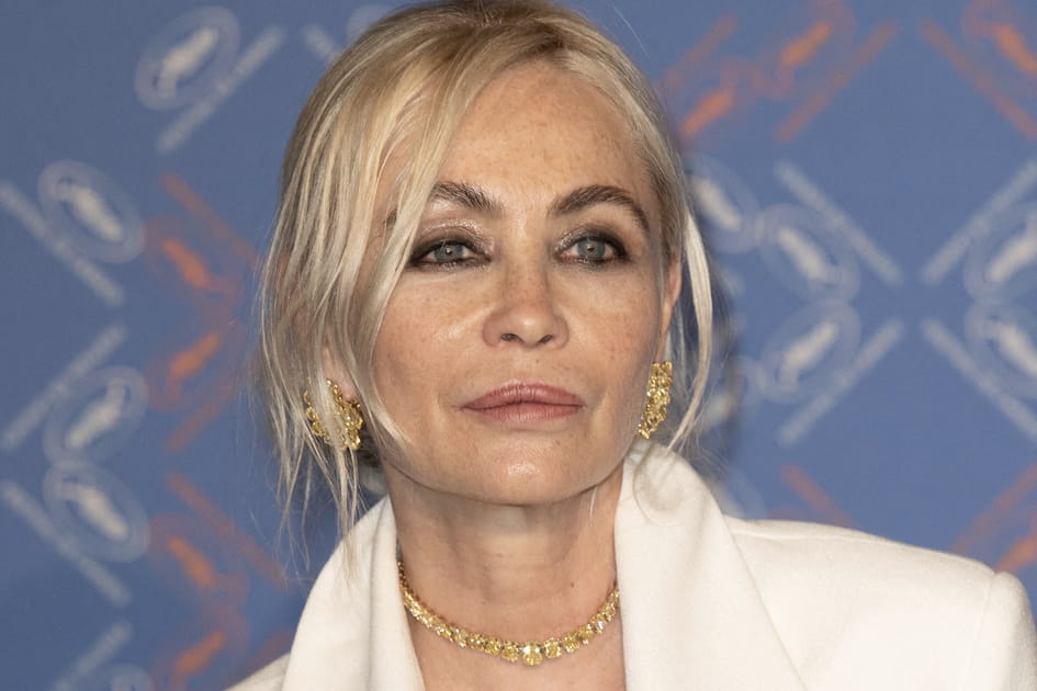 Emmanuelle B&eacute;art, apr&egrave;s sa chirurgie des l&egrave;vres