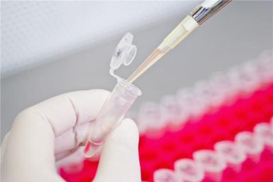Des cellules cannibales pourraient bientôt bloquer le cancer du pancréas