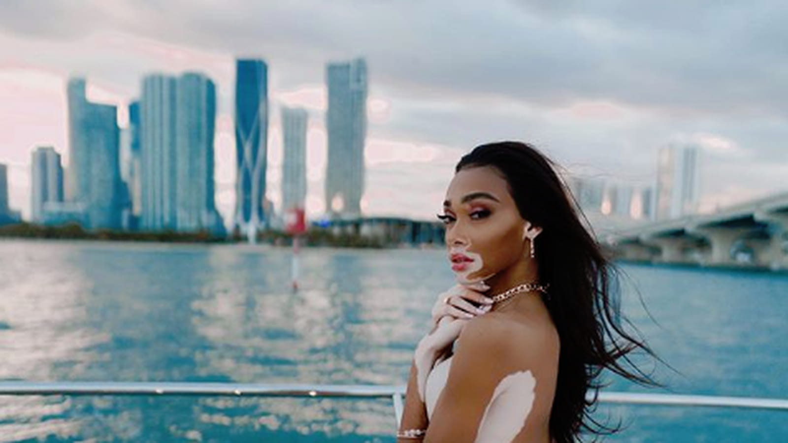 Winnie Harlow 