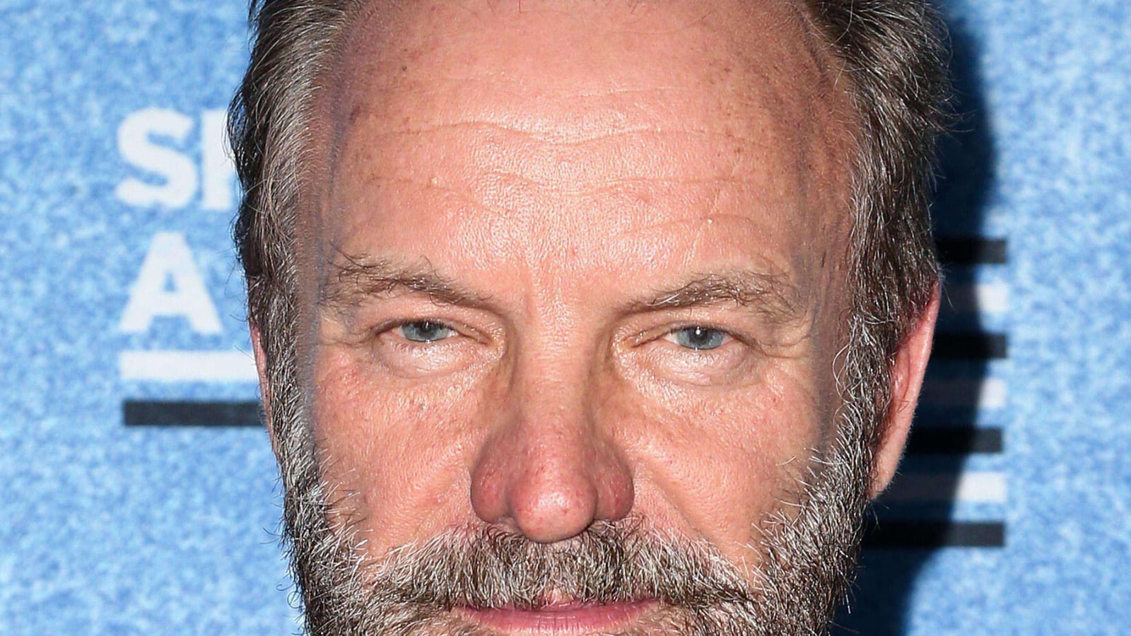 Sting