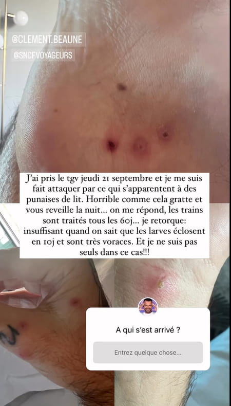 mathieu-punaises-de-lit-scnf-photo