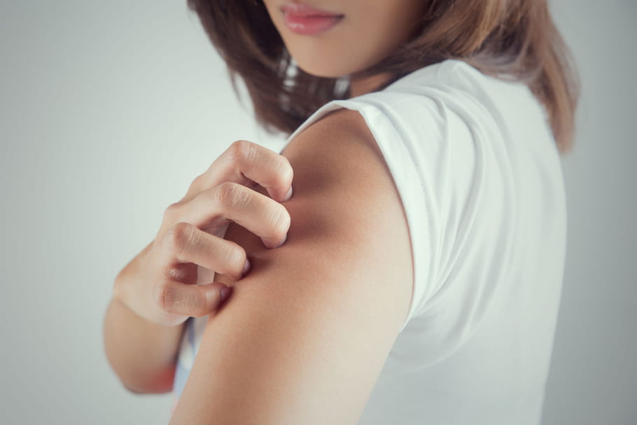 Comment éviter les poussées d'eczéma