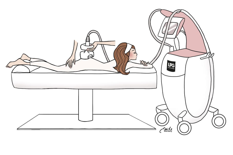 Cellu M6 LPG et cellulite : avis et tarifs sur cet appareil minceur
