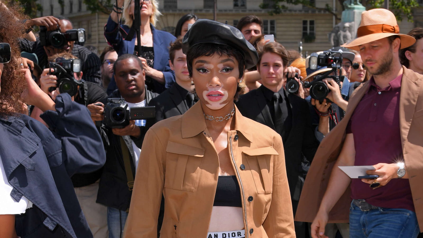 Winnie Harlow
