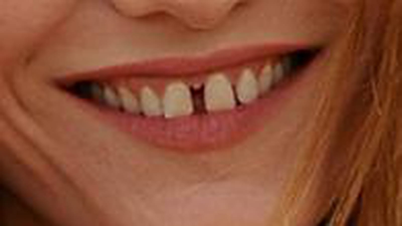 Avec les dents du bonheur ?