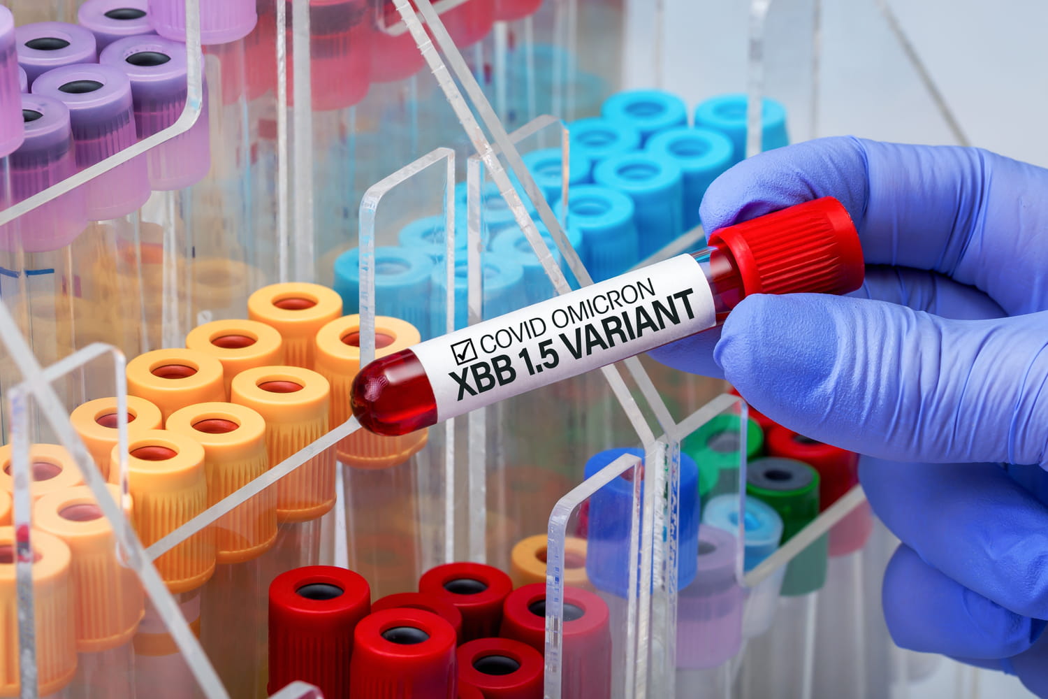 Variant Covid XBB 1.5 : en France, symptômes, dangereux pour qui ?